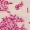 Bacteriodes fragilis